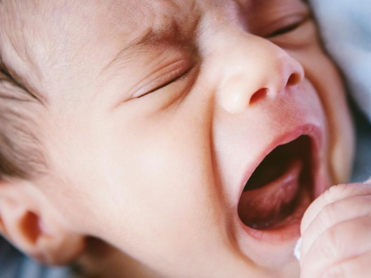 Sinais na Amamentação Que Podem Indicar Frênulo Lingual Alterado